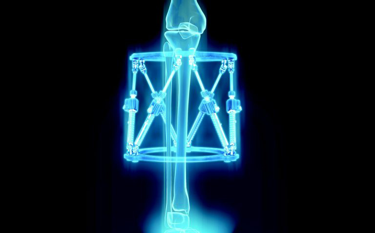 DePuy-Synthes-3D-smalle